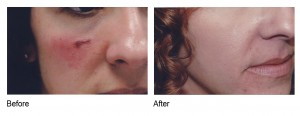 E2 Serum before and after gallery houston tx