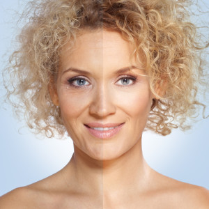 IPL Photofacial® Laser Houston TX